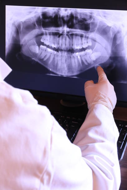 Best Emergency Dentist for Lost Fillings or Crowns in Lake Park, IA